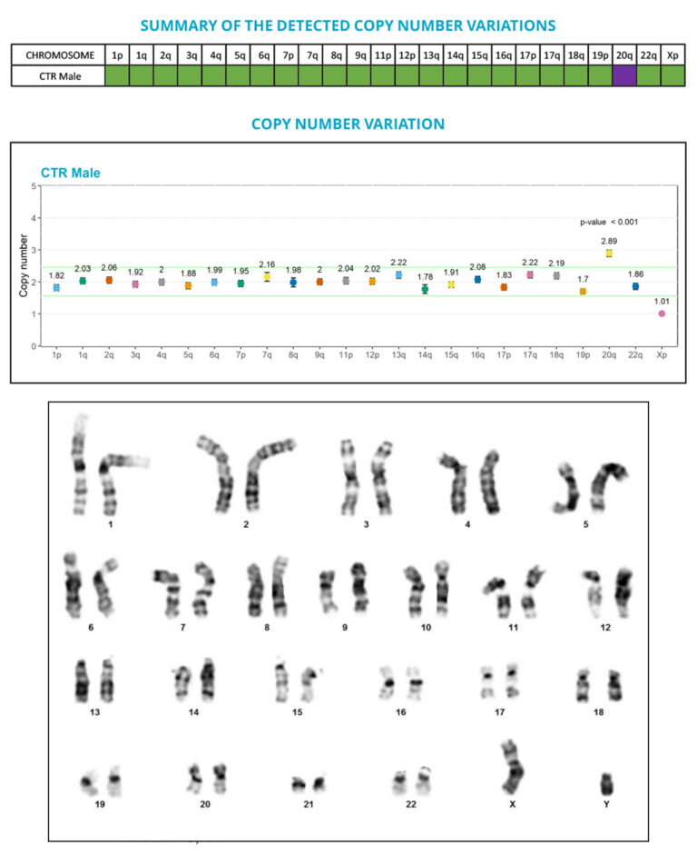 G-banding karyotype alone will only detect abnormalities > 5-10 Mb.